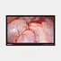 UHD MEDICAL LCD MONITOR